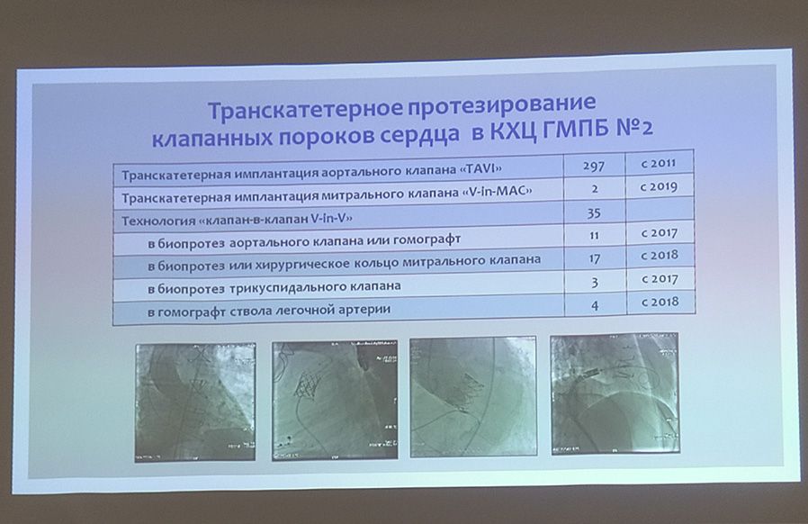 280-Е Заседание Секции Сердечно-Сосудистых Хирургов И Ангиологов - Фотография1